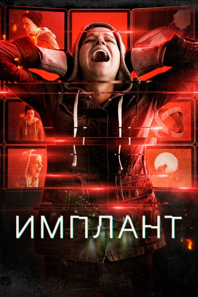 Implanted