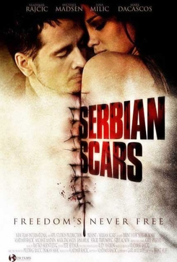 Serbian Scars