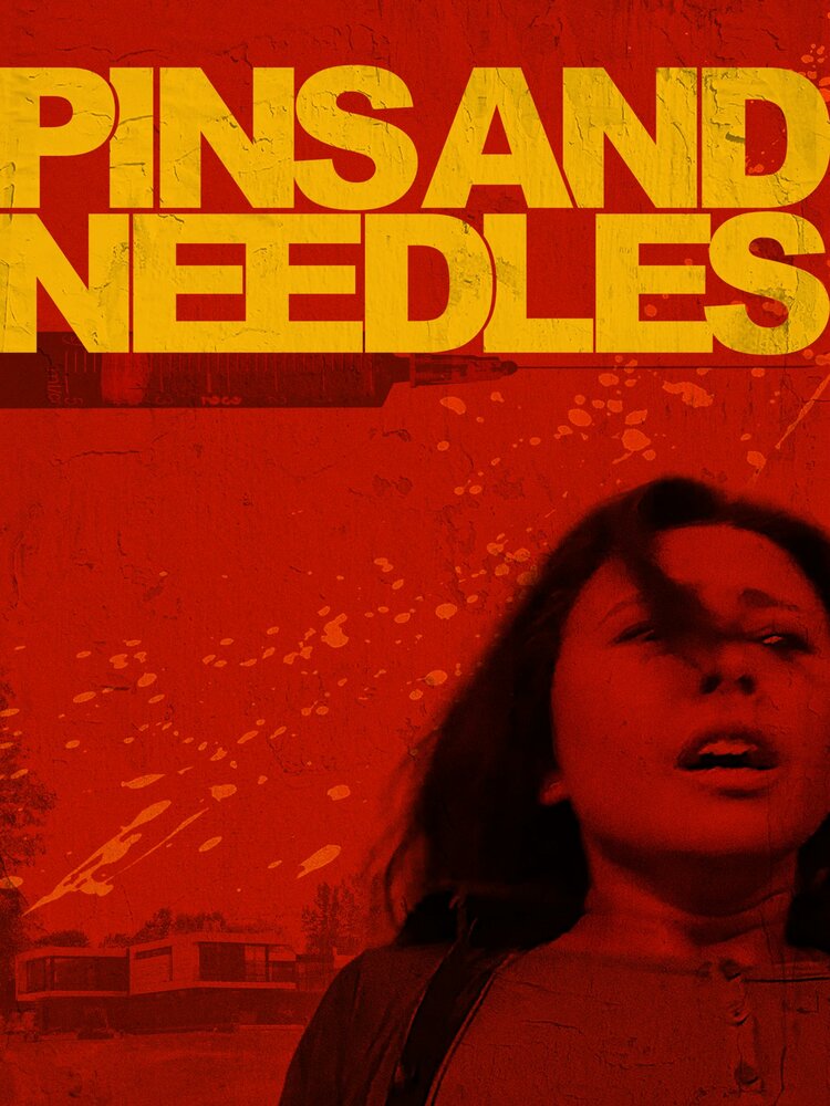 Pins & Needles